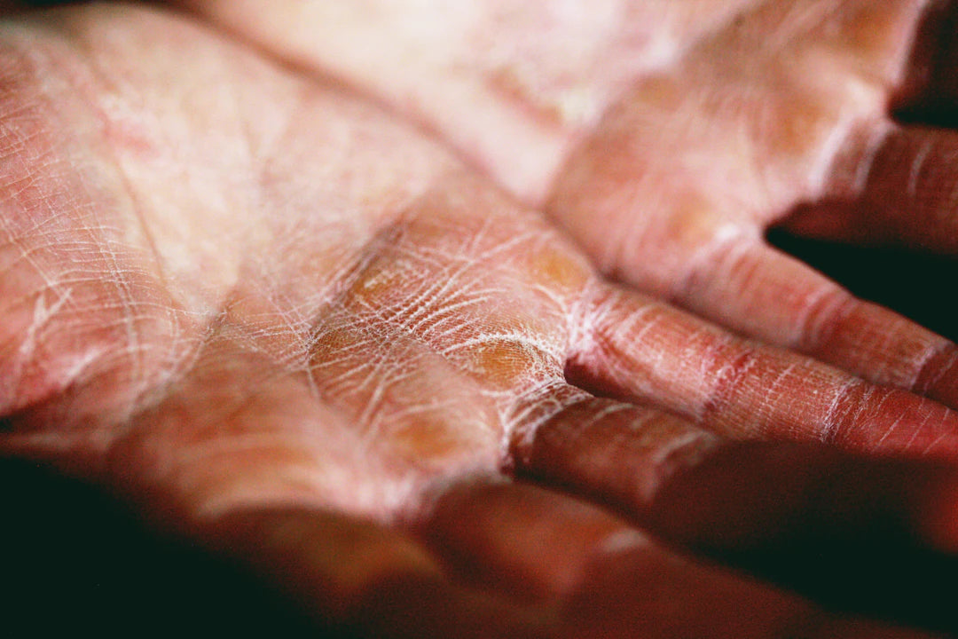 When Should You Consult a Dermatologist for Skincare