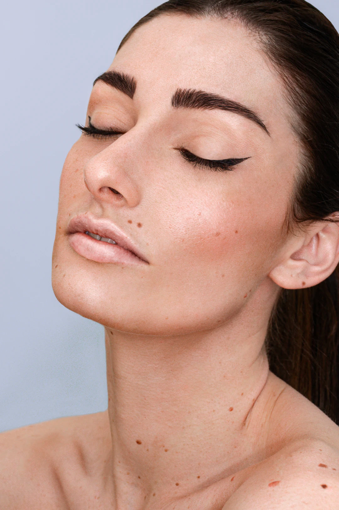 Top Tips for Managing Hyperpigmentation Effectively
